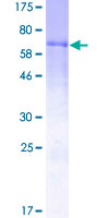 F7 / Factor VII Protein - 12.5% SDS-PAGE of human F7 stained with Coomassie Blue