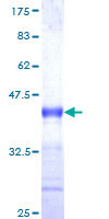 F7 / Factor VII Protein - 12.5% SDS-PAGE Stained with Coomassie Blue.