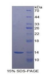 F7 / Factor VII Protein - Recombinant Coagulation Factor VII By SDS-PAGE