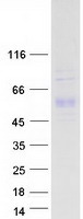 F7 / Factor VII Protein - Purified recombinant protein F7 was analyzed by SDS-PAGE gel and Coomassie Blue Staining