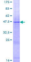 F8 / FVIII / Factor VIII Protein - 12.5% SDS-PAGE of human F8 stained with Coomassie Blue