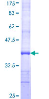 F8 / FVIII / Factor VIII Protein - 12.5% SDS-PAGE Stained with Coomassie Blue.