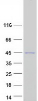 F8A2 Protein - Purified recombinant protein F8A2 was analyzed by SDS-PAGE gel and Coomassie Blue Staining