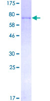 F9 / Factor IX Protein - 12.5% SDS-PAGE of human F9 stained with Coomassie Blue