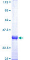 F9 / Factor IX Protein - 12.5% SDS-PAGE Stained with Coomassie Blue.