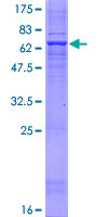 FA2H / FAAH Protein - 12.5% SDS-PAGE of human FA2H stained with Coomassie Blue