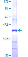 FAAH Protein - 12.5% SDS-PAGE Stained with Coomassie Blue.