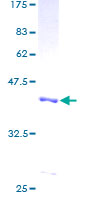 FABP1 / L-FABP Protein - 12.5% SDS-PAGE of human FABP1 stained with Coomassie Blue