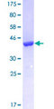 FABP3 / H-FABP Protein - 12.5% SDS-PAGE of human FABP3 stained with Coomassie Blue