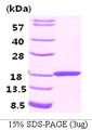 FABP3 / H-FABP Protein