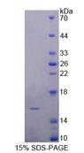 FABP4 / AP2 Protein - Recombinant Fatty Acid Binding Protein 4, Adipocyte By SDS-PAGE