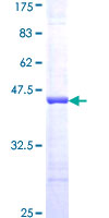 FABP7 / BLBP / MRG Protein - 12.5% SDS-PAGE of human FABP7 stained with Coomassie Blue