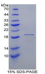 FABP9 / Lipid-Binding Protein Protein - Recombinant Fatty Acid Binding Protein 9, Testis By SDS-PAGE