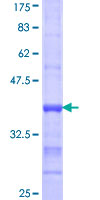 FACL2 / ACSL1 Protein - 12.5% SDS-PAGE Stained with Coomassie Blue.