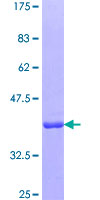 FACT / SSRP1 Protein - 12.5% SDS-PAGE Stained with Coomassie Blue.