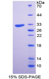 FACT / SSRP1 Protein - Recombinant Structure Specific Recognition Protein 1 By SDS-PAGE