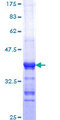 FADD Protein - 12.5% SDS-PAGE Stained with Coomassie Blue.