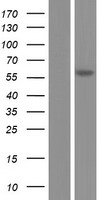 FADS1 Protein - Western validation with an anti-DDK antibody * L: Control HEK293 lysate R: Over-expression lysate