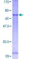 FADS1 Protein - 12.5% SDS-PAGE of human FADS1 stained with Coomassie Blue