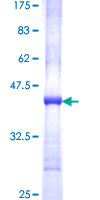 FADS1 Protein - 12.5% SDS-PAGE Stained with Coomassie Blue.