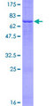 FADS3 Protein - 12.5% SDS-PAGE of human FADS3 stained with Coomassie Blue
