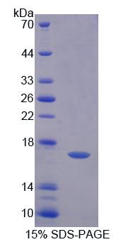 FADS3 Protein - Recombinant  Fatty Acid Desaturase 3 By SDS-PAGE