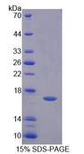 FADS3 Protein - Recombinant  Fatty Acid Desaturase 3 By SDS-PAGE