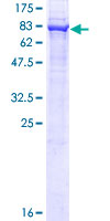 FAF2 / ETEA Protein - 12.5% SDS-PAGE of human UBXD8 stained with Coomassie Blue