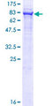 FAF2 / ETEA Protein - 12.5% SDS-PAGE of human UBXD8 stained with Coomassie Blue