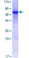 FAH Protein - 12.5% SDS-PAGE of human FAH stained with Coomassie Blue