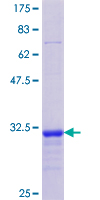 FAH Protein - 12.5% SDS-PAGE Stained with Coomassie Blue.