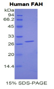 FAH Protein - Recombinant Fumarylacetoacetate Hydrolase By SDS-PAGE