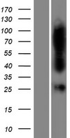 FAHD1 Protein - Western validation with an anti-DDK antibody * L: Control HEK293 lysate R: Over-expression lysate