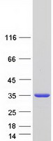 FAHD1 Protein - Purified recombinant protein FAHD1 was analyzed by SDS-PAGE gel and Coomassie Blue Staining