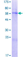 FAHD2A Protein - 12.5% SDS-PAGE of human FAHD2A stained with Coomassie Blue