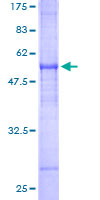 FAIM2 / LIFEGUARD Protein - 12.5% SDS-PAGE of human FAIM2 stained with Coomassie Blue