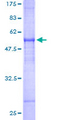 FAIM2 / LIFEGUARD Protein - 12.5% SDS-PAGE of human FAIM2 stained with Coomassie Blue