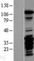 FAK / Focal Adhesion Kinase Protein - Western validation with an anti-DDK antibody * L: Control HEK293 lysate R: Over-expression lysate