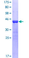 FAK / Focal Adhesion Kinase Protein - 12.5% SDS-PAGE Stained with Coomassie Blue.