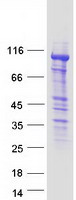 FAK / Focal Adhesion Kinase Protein - Purified recombinant protein PTK2 was analyzed by SDS-PAGE gel and Coomassie Blue Staining
