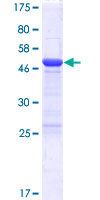 FAM102A Protein - 12.5% SDS-PAGE of human FAM102A stained with Coomassie Blue