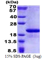 FAM107B Protein