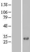 FAM109A Protein - Western validation with an anti-DDK antibody * L: Control HEK293 lysate R: Over-expression lysate