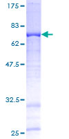 FAM110B / C8orf72 Protein - 12.5% SDS-PAGE of human MGC39325 stained with Coomassie Blue