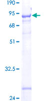 FAM113A Protein - 12.5% SDS-PAGE of human C20orf81 stained with Coomassie Blue