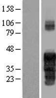 FAM122A Protein - Western validation with an anti-DDK antibody * L: Control HEK293 lysate R: Over-expression lysate