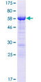 FAM122A Protein - 12.5% SDS-PAGE of human FAM122A stained with Coomassie Blue