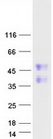 FAM122A Protein - Purified recombinant protein FAM122A was analyzed by SDS-PAGE gel and Coomassie Blue Staining