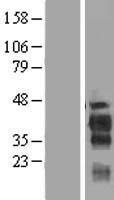 FAM122B Protein - Western validation with an anti-DDK antibody * L: Control HEK293 lysate R: Over-expression lysate