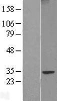 FAM124B Protein - Western validation with an anti-DDK antibody * L: Control HEK293 lysate R: Over-expression lysate